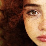 كيفية التخلص من النمش؟ كيفية التخلص من النمش؟
