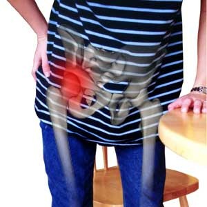علاج أمراض الورك العلاجات الشعبية المشتركة