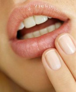 كيفية علاج الهربس