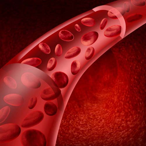 التهاب الأوعية الدموية - ما هو؟ الأعراض والصور والعلاج